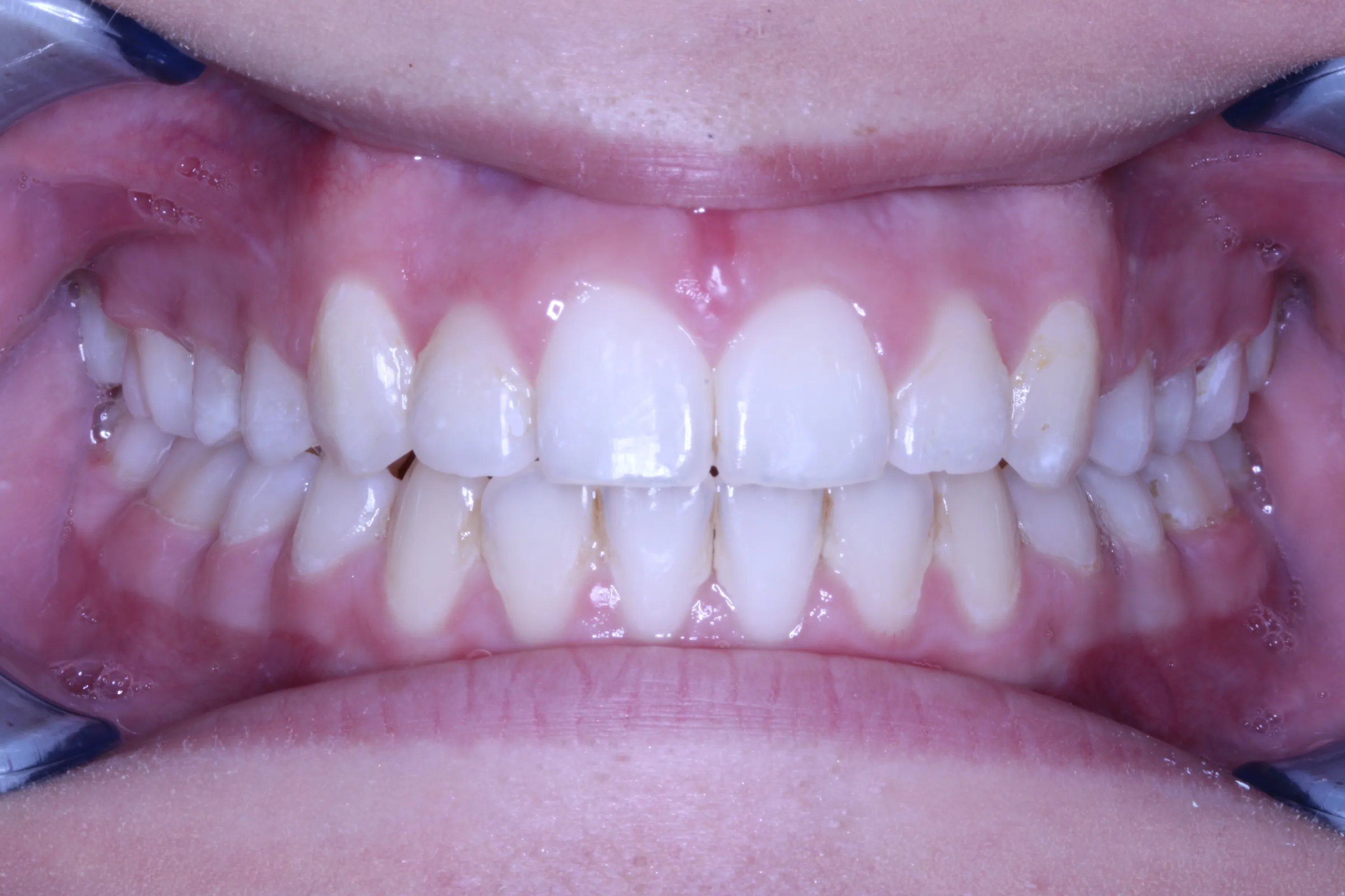 smile-gallery gallery